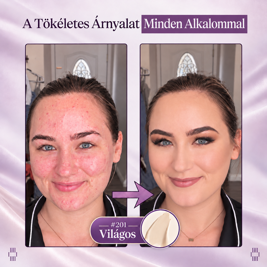 Célzott felvitel kisebb területekre