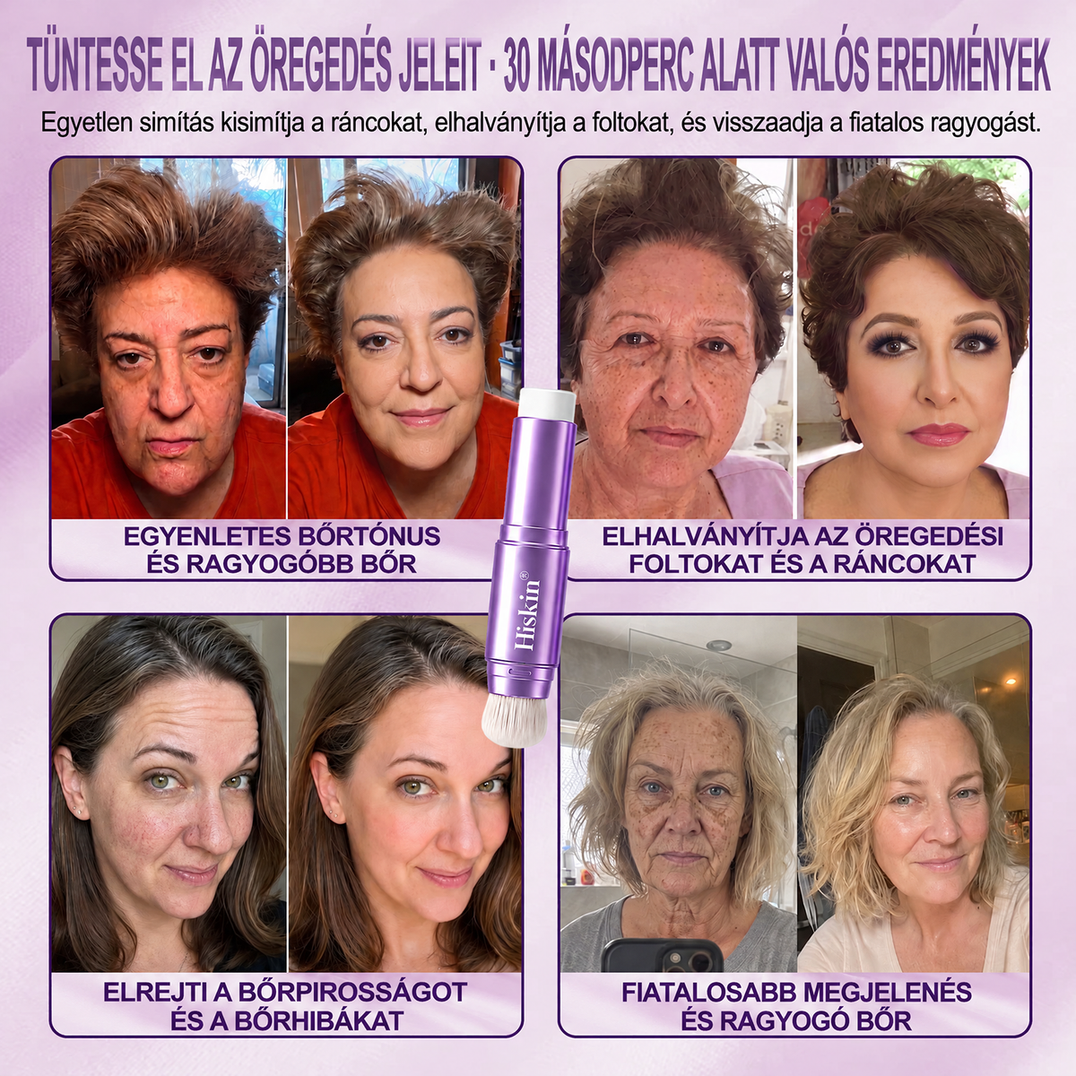 🔥 𝐀𝐙 𝐔𝐓𝐎𝐋𝐒Ó 𝟐 Ó𝐑Á𝐁𝐀𝐍 · 𝟖𝟎% 𝐊𝐄𝐃𝐕𝐄𝐙𝐌É𝐍𝐘! 𝐇𝐢𝐬𝐤𝐢𝐧® 𝟐 𝐚𝐳 𝟏-𝐛𝐞𝐧 𝐬𝐳í𝐧𝐯á𝐥𝐭ó 𝐚𝐥𝐚𝐩𝐨𝐳ó 𝐬𝐭𝐢𝐟𝐭 | 𝐄𝐥𝐟𝐞𝐝𝐢 𝐚𝐳 ö𝐫𝐞𝐠𝐬é𝐠𝐢 𝐟𝐨𝐥𝐭𝐨𝐤𝐚𝐭, 𝐡𝐚𝐥𝐯á𝐧𝐲í𝐭𝐣𝐚 𝐚 𝐟𝐢𝐧𝐨𝐦 𝐫á𝐧𝐜𝐨𝐤 𝐥á𝐭𝐡𝐚𝐭ó𝐬á𝐠á𝐭 é𝐬 𝐡𝐢𝐝𝐫𝐚𝐭á𝐥𝐣𝐚 𝐚 𝐛ő𝐫𝐭 – 𝐛𝐞é𝐩í𝐭𝐞𝐭𝐭 𝐞𝐜𝐬𝐞𝐭𝐭𝐞𝐥 𝐚 𝐟𝐢𝐚𝐭𝐚𝐥𝐨𝐬, 𝐫𝐚𝐠𝐲𝐨𝐠ó 𝐚𝐫𝐜𝐛ő𝐫é𝐫𝐭!