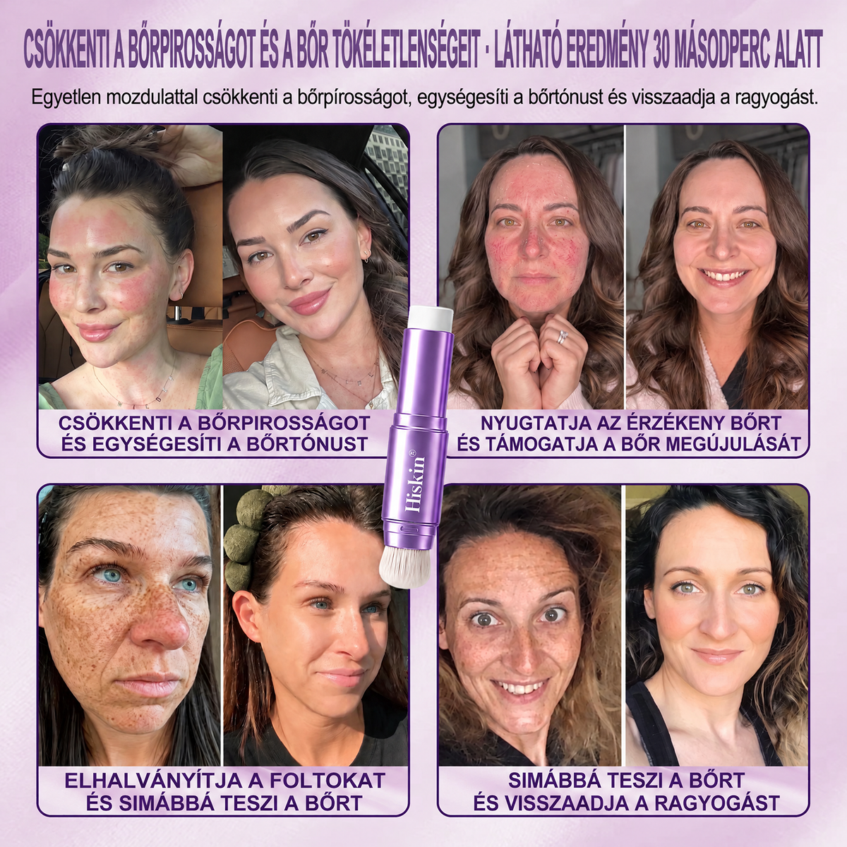 🔥 𝐀𝐙 𝐔𝐓𝐎𝐋𝐒Ó 𝟐 Ó𝐑Á𝐁𝐀𝐍 · 𝟖𝟎% 𝐊𝐄𝐃𝐕𝐄𝐙𝐌É𝐍𝐘! 𝐇𝐢𝐬𝐤𝐢𝐧® 𝟐 𝐚𝐳 𝟏-𝐛𝐞𝐧 𝐬𝐳í𝐧𝐯á𝐥𝐭ó 𝐚𝐥𝐚𝐩𝐨𝐳ó 𝐬𝐭𝐢𝐟𝐭 | 𝐄𝐥𝐟𝐞𝐝𝐢 𝐚𝐳 ö𝐫𝐞𝐠𝐬é𝐠𝐢 𝐟𝐨𝐥𝐭𝐨𝐤𝐚𝐭, 𝐡𝐚𝐥𝐯á𝐧𝐲í𝐭𝐣𝐚 𝐚 𝐟𝐢𝐧𝐨𝐦 𝐫á𝐧𝐜𝐨𝐤 𝐥á𝐭𝐡𝐚𝐭ó𝐬á𝐠á𝐭 é𝐬 𝐡𝐢𝐝𝐫𝐚𝐭á𝐥𝐣𝐚 𝐚 𝐛ő𝐫𝐭 – 𝐛𝐞é𝐩í𝐭𝐞𝐭𝐭 𝐞𝐜𝐬𝐞𝐭𝐭𝐞𝐥 𝐚 𝐟𝐢𝐚𝐭𝐚𝐥𝐨𝐬, 𝐫𝐚𝐠𝐲𝐨𝐠ó 𝐚𝐫𝐜𝐛ő𝐫é𝐫𝐭!